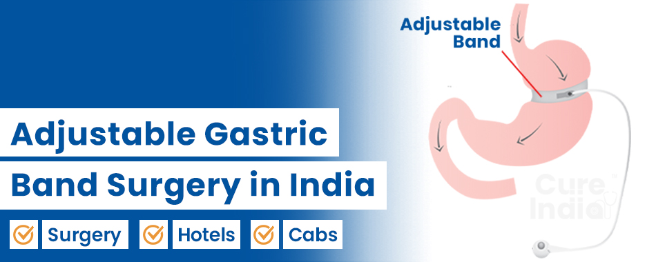Adjustable Gastric Band
