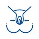 Hymenoplasty