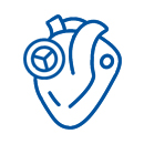 Aortic Valve Replacement