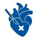 Open Heart Surgery