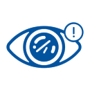 Corneal Abrasion