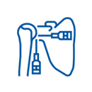 Arthroscopic Bankart Repair