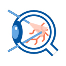 Vitrectomy Surgery
