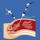 cureindia