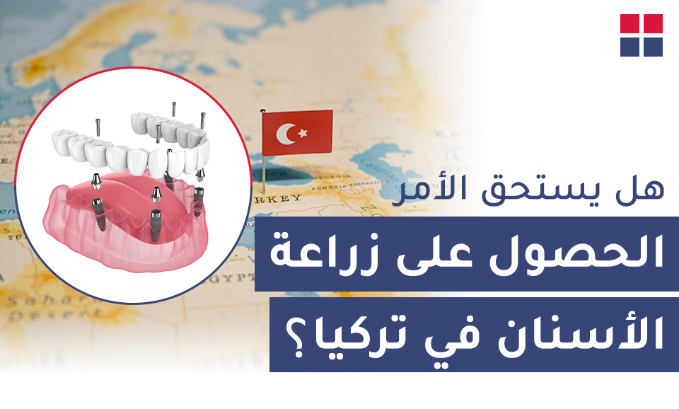 هل يستحق الأمر الحصول على زراعة الأسنان في تركيا؟