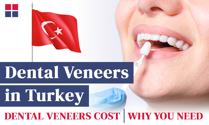 Why Are Veneers Cheaper in Turkey?