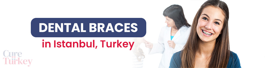 Dental Braces in Istanbul