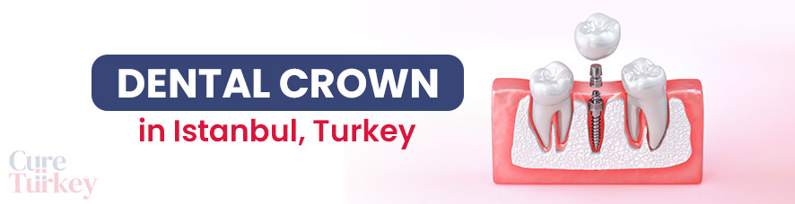 Dental Crown in Istanbul