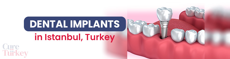 Dental implant in Istanbul