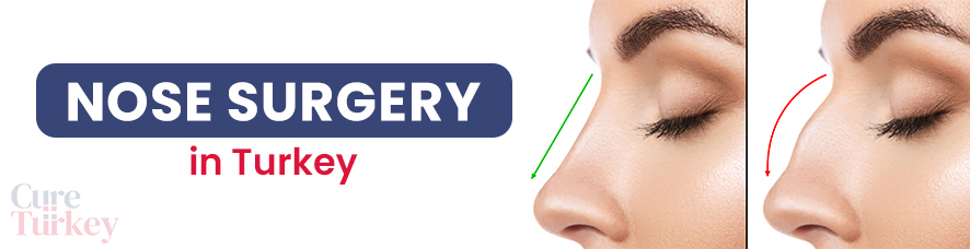 Nose Surgery