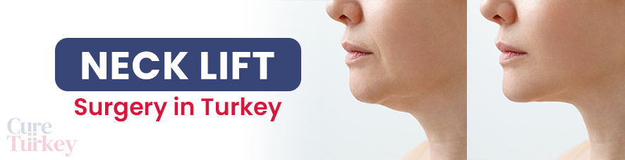 Neck lift