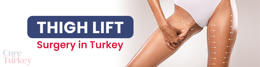 Thigh Lift