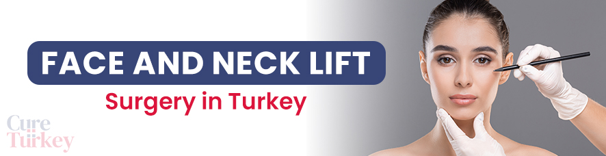 Face and Neck Lift