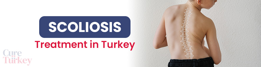 Scoliosis Treatment