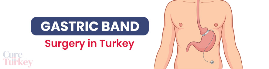 Gastric Band Surgery