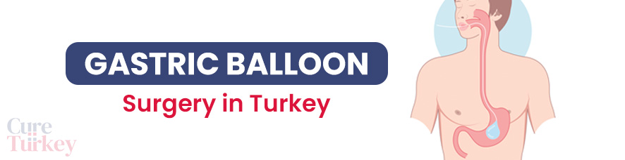 Gastric Balloon Surgery