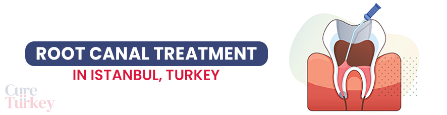 Root Canal - Istanbul