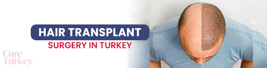 Hair Transplant