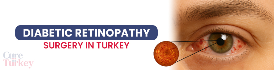 Diabetic Retinopathy Treatment