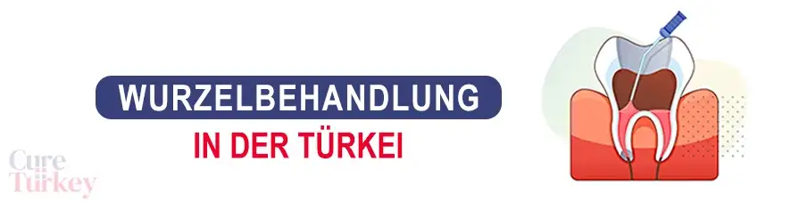 Wurzelbehandlung