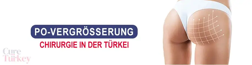Po-Vergrößerung