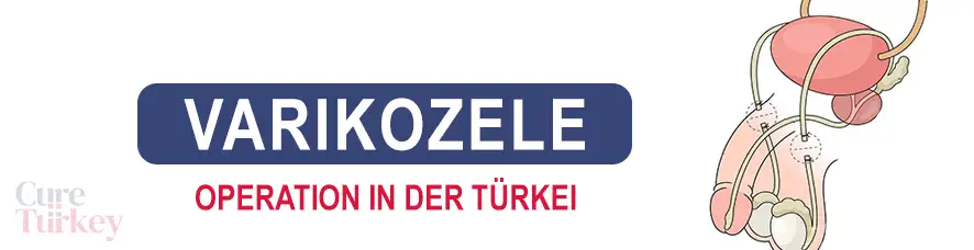 Vasektomie