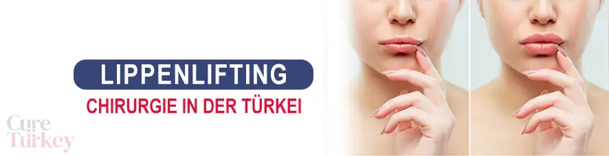 Lippenlifting in der Türkei
