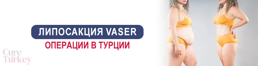 Круговая липосакция 360
