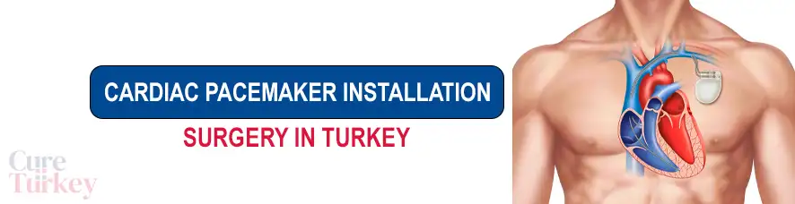 Cardiac Pacemaker Installation