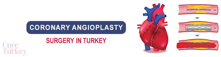 Coronary Angioplasty