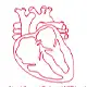 Artrial Septal Defect